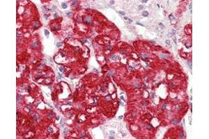 Immunohistochemical analysis of paraffin-embedded human adrenal tissues using STYK1/NOK mouse mAb with DAB staining. (STYK1 antibody)