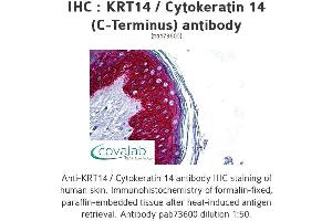 Image no. 1 for anti-Keratin 14 (KRT14) (C-Term) antibody (ABIN2851957) (KRT14 antibody  (C-Term))