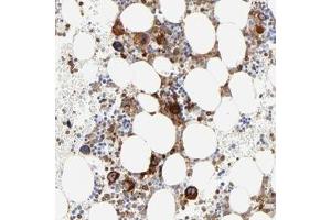 Immunohistochemical staining of human bone marrow with FLNA polyclonal antibody  shows strong cytoplasmic positivity in bone marrow poietic cells at 1:200-1:500 dilution. (Filamin A antibody)