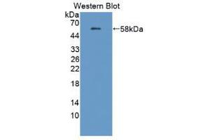 Western blot analysis of the recombinant protein. (Amyloid beta (A4) Precursor Protein-Binding, Family B, Member 1 Interacting Protein (APBB1IP) (AA 188-421) antibody)