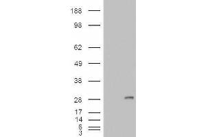 HEK293 overexpressing IGFBP6 (ABIN5403880) and probed with ABIN263197 (mock transfection in first lane). (IGFBP6 antibody  (Internal Region))