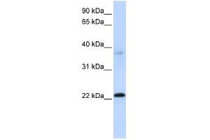 WB Suggested Anti-C11orf74 Antibody Titration: 0. (C11ORF74 antibody  (Middle Region))