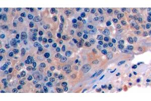 Detection of FAS in Human Tonsil Tissue using Polyclonal Antibody to Factor Related Apoptosis (FAS)