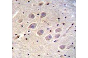 Immunohistochemistry (IHC) image for anti-Nerve Growth Factor Receptor (NGFR) (AA 353-380) antibody (ABIN3031958)