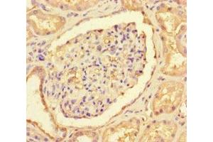 Immunohistochemistry of paraffin-embedded human kidney tissue using ABIN7147089 at dilution of 1:100 (CNOT1 antibody  (AA 604-867))