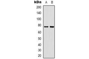 Western blot analysis of Rabphilin 3A expression in Hela (A), mouse muscle (B) whole cell lysates. (RPH3A antibody)