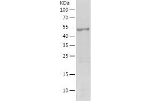 Western Blotting (WB) image for Melanoma Antigen Family A, 11 (MAGEA11) (AA 78-429) protein (His tag) (ABIN7283120) (MAGEA11 Protein (AA 78-429) (His tag))