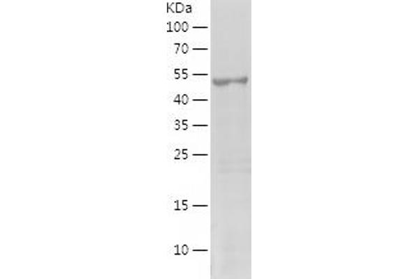 MAGEA11 Protein (AA 78-429) (His tag)