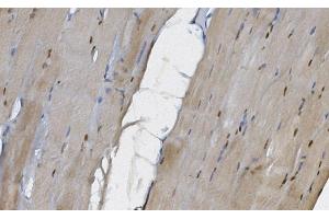 IHC analysis of MEK5/MAP2K5 using anti-MEK5/MAP2K5 antibody (ABIN7602630). (MAP2K5 antibody  (AA 9-442))