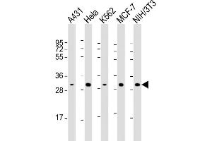 Lane 1: A431 Cell lysates, Lane 2: HeLa Cell lysates, Lane 3: K562 Cell lysates, Lane 4: MCF-7 Cell lysates, Lane 5: NIH/3T3 Cell lysates, probed with CDK4 (1529CT850. (CDK4 antibody)