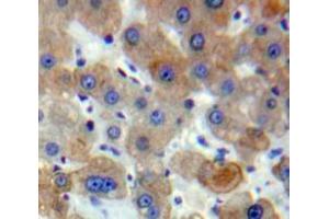 Used in DAB staining on fromalin fixed paraffin-embedded Liver tissue (ACTC1 antibody  (AA 156-368))