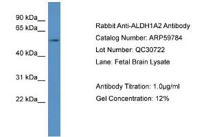WB Suggested Anti-ALDH1A2  Antibody Titration: 0.