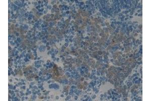 Detection of PAI2 in Rat Spleen Tissue using Monoclonal Antibody to Plasminogen Activator Inhibitor 2 (PAI2) (SERPINB2 antibody  (AA 154-408))