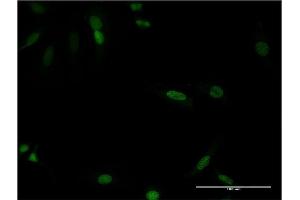 Immunofluorescence of monoclonal antibody to CDX4 on HeLa cell. (CDX4 antibody  (AA 202-284))