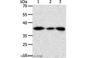 Western blot analysis of Human liver cancer tissue, hela cell and human fetal kidney tissue, using AKR1A1 Polyclonal Antibody at dilution of 1:450 (AKR1A1 antibody)