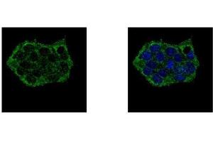 ICC/IF Image EPB41L3 antibody [C3], C-term detects EPB41L3 protein at cytoplasm by confocal immunofluorescent analysis.