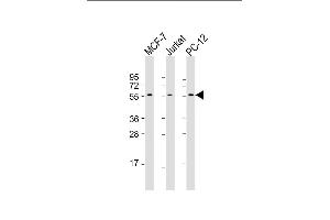 All lanes : Anti-AKT2 Antibody at 1:1000-1:2000 dilution Lane 1: MCF-7 whole cell lysate Lane 2: Jurkat whole cell lysate Lane 3: PC-12 whole cell lysate Lysates/proteins at 20 μg per lane. (AKT2 antibody  (AA 272-481))