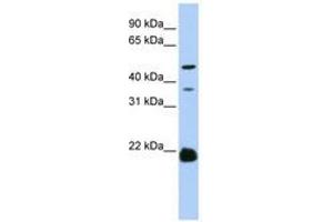 Image no. 1 for anti-Zinc Finger, DHHC-Type Containing 14 (ZDHHC14) (AA 108-157) antibody (ABIN6740780) (ZDHHC14 antibody  (AA 108-157))