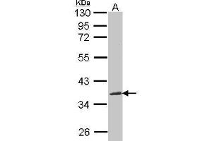 WB Image Sample(30 ug whole cell lysate) A:293T 12% SDS PAGE antibody diluted at 1:1000 (NOV antibody  (Center))