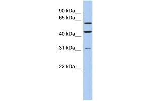 WB Suggested Anti-ZNF179 Antibody Titration:  0. (RNF112 antibody  (Middle Region))