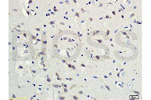 Formalin-fixed and paraffin embedded rat brain tissue labeled with Rabbit Anti-gremlin Polyclonal Antibody (ABIN687082) at 1:200 followed by conjugation to the secondary antibody and DAB staining.