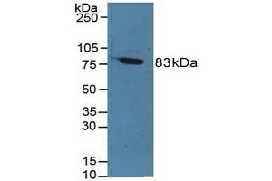 Detection of F13A1 in Rat Serum using Polyclonal Antibody to Coagulation Factor XIII A1 Polypeptide (F13A1) (F13A1 antibody  (AA 140-377))