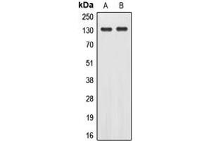 Western blot analysis of EPHA2 (pY588) expression in A431 (A), H1299 (B) whole cell lysates.