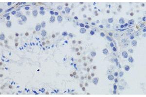 Immunohistochemistry of paraffin-embedded Mouse testis using TriMethyl-Histone H4-K20 Polyclonal Antibody at dilution of 1:200 (40x lens).