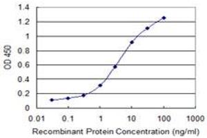 Detection limit for recombinant GST tagged DAPK2 is 0. (DAPK2 antibody  (AA 281-370))