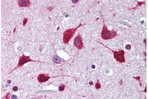 Human Brain, Cortex (formalin-fixed, paraffin-embedded) stained with SOX2 antibody ABIN239849 at 1:50 followed by biotinylated goat anti-rabbit IgG secondary antibody ABIN481713, alkaline phosphatase-streptavidin and chromogen. (SOX2 antibody  (N-Term))