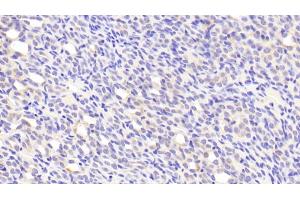 Detection of PEDF in Mouse Kidney Tissue using Polyclonal Antibody to Pigment Epithelium Derived Factor (PEDF) (PEDF antibody  (AA 19-417))
