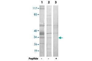 Western blot analysis of extracts from HepG2 cells (Lane 1 and lane 3) and COLO 205 cells (Lane 2), using HNRNPC polyclonal antibody .