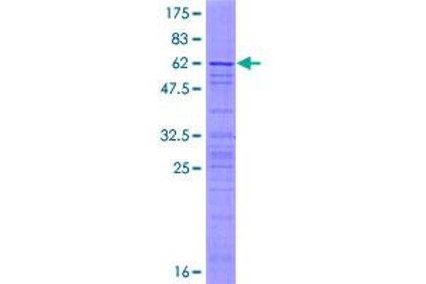 AP3S2 Protein (AA 1-193) (GST tag)