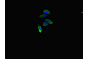 Immunofluorescent analysis of HepG2 cells using ABIN7167919 at dilution of 1:100 and Alexa Fluor 488-congugated AffiniPure Goat Anti-Rabbit IgG(H+L) (ARHGAP1 antibody  (AA 542-744))