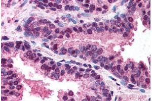 Immunohistochemistry (Paraffin-embedded Sections) (IHC (p)) image for anti-Tumor Necrosis Factor Receptor Superfamily, Member 10b (TNFRSF10B) (C-Term) antibody (ABIN213934)