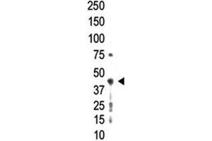 Western blot analysis of PRMT2 antibody and whole HL-60 cell lysate (PRMT2 antibody  (AA 344-375))
