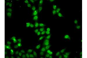 Immunofluorescence analysis of A549 cells using HDGFRP2 antibody (ABIN5975300). (HDGFRP2 antibody)