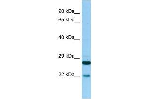 WB Suggested Anti-PTGES2 Antibody Titration: 1. (PTGES2 antibody  (N-Term))