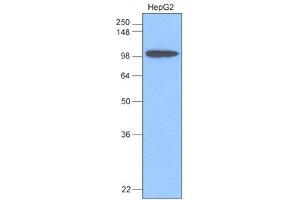Western Blotting (WB) image for anti-Hexokinase 1 (HK1) antibody (ABIN306422) (Hexokinase 1 antibody)