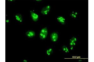Immunofluorescence of purified MaxPab antibody to PES1 on HeLa cell. (PES1 antibody  (AA 1-588))
