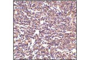 Immunohistochemistry of RP105 in human spleen tissue with this product at 2 μg/ml. (CD180 antibody  (Center))