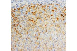IHC-P: FGF8 antibody testing of rat ovary tissue (FGF8 antibody  (C-Term))