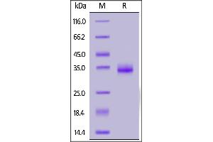 SARS-CoV-2 S protein RBD (K417N, E484K, N501Y), His Tag on  under reducing (R) condition.