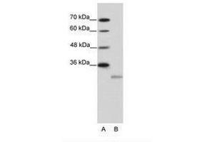Image no. 1 for anti-Eukaryotic Translation Initiation Factor 4E Family Member 2 (EIF4E2) (N-Term) antibody (ABIN202116) (EIF4E2 antibody  (N-Term))