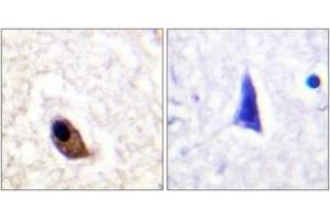 Immunohistochemistry analysis of paraffin-embedded human brain, using NMDAR2A/B (Phospho-Tyr1246/1252) Antibody. (NMDAR2A + 2B antibody  (pTyr1246))