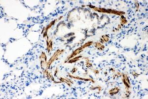 Anti- ATP2A2 antibody,IHC(P) IHC(P): Rat Lung Tissue (ATP2A2 antibody  (N-Term))
