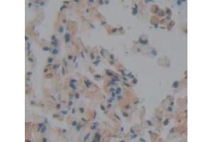 IHC-P analysis of Human Tissue, with DAB staining. (Peroxidasin antibody  (AA 76-260))