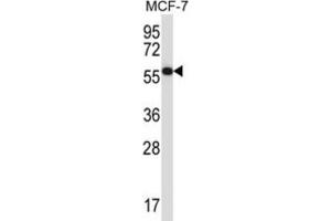 Western Blotting (WB) image for anti-Mitogen-Activated Protein Kinase Associated Protein 1 (MAPKAP1) antibody (ABIN2997754) (MAPKAP1 antibody)