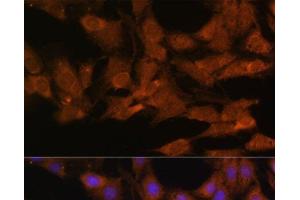 Immunofluorescence analysis of C6 cells using DDX3X Polyclonal Antibody at dilution of 1:100.