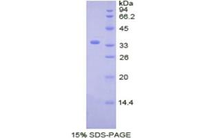 SDS-PAGE analysis of Human CDK4 Protein. (CDK4 Protein)